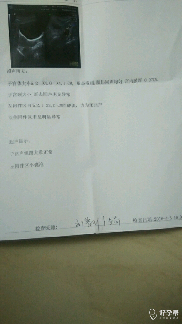 经期推迟两个月，原因、影响与对策